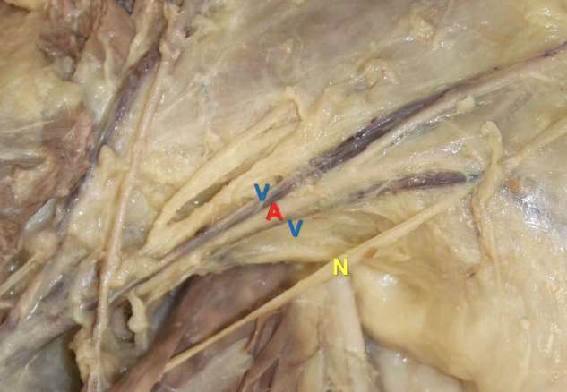 Artery&vein vs. nerve photo.png