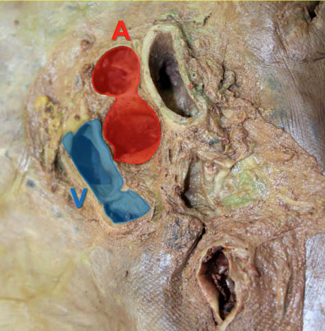 Artery vs. vein photo.png